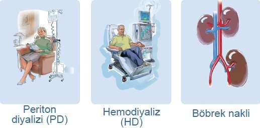 Entegre Diyaliz Tedavisi Diyaliz modaliteleri