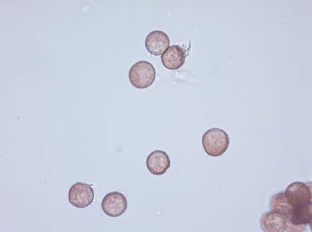 2 mm çapında; peridium ince, mikroskop ışığında sarımsı kahverengi, küçük parçalarla dolu; sporlar yığın halinde koyu kahverengi-siyah renkte, mikroskop ışığında açık sarımsı kahverengi, 10-14 (16)