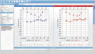 AudioStar Pro ihtiyaç duyulan tüm özelliklere sahiptir, örn.