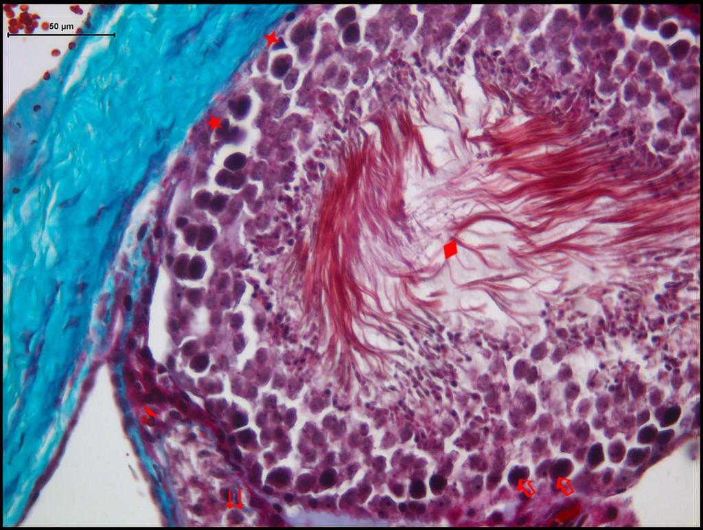 Resim 5: Kontrol grubuna ait testis dokusunda üçlü boya ile boyanmış kesitlerde; spermatogonyumlar ( ), iri spermatosit I ler ( ),lümende spermium lar (