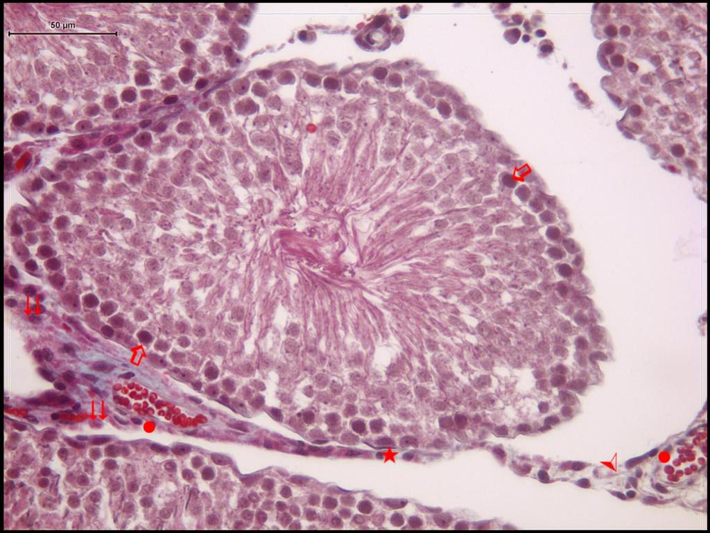 Resim 6: Melatonin grubuna ait testis dokusunda üçlü boya ile boyanmış kesitlerde; Spermatogonyumlar ( ),