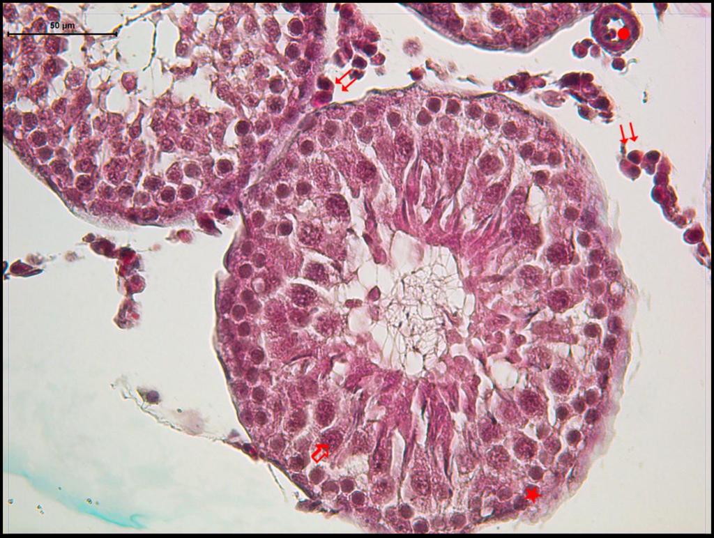 Resim 8:Radyasyon ve Melatonin uygulanan gruba ait testis dokusunda üçlü boya ile boyanmış kesitlerde;spermatogonyumlar (