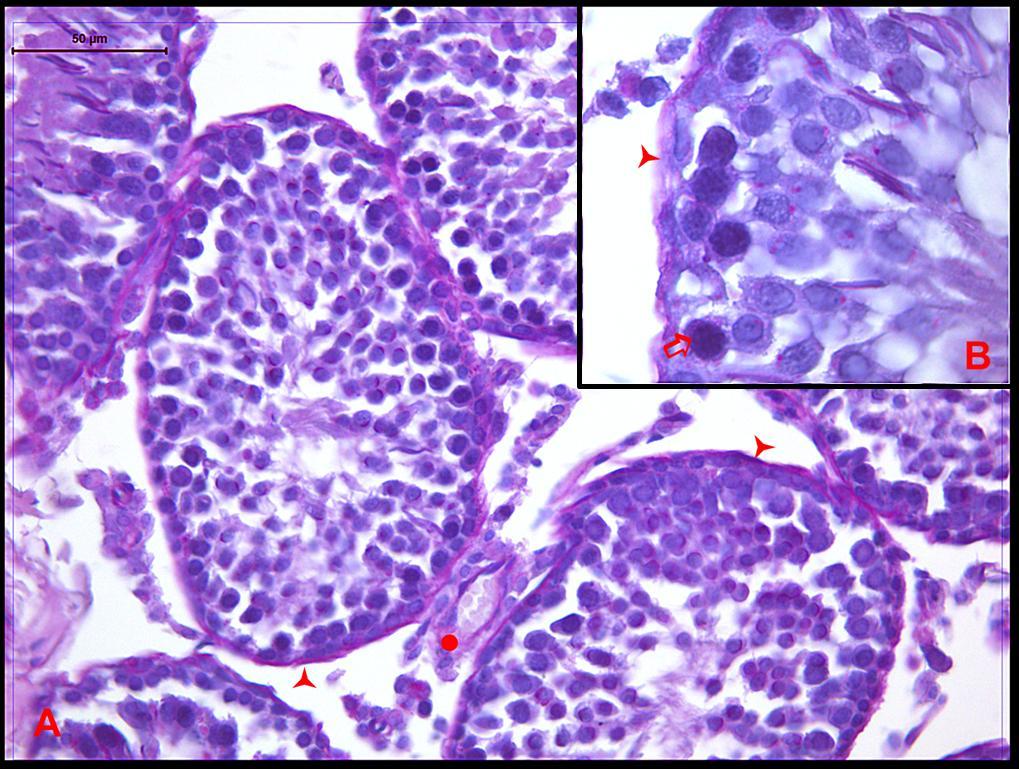 Resim 12:Radyasyon ve Melatonin uygulanan gruba ait testis dokusunda PAS ile işaretlenmiş kesitlerde; spermatogenik epitelde