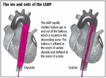 İntraaortik balon pompası (IABP) İntraaortik balon pompası (IABP) Sistolik sol ventrikül afterloadunu azaltır ve diastolik koroner perfüzyon basıncını artırır Kardiyak output artar ve koroner arter