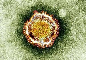 Virüsler-viroidler ve özellikleri Virüsler zorunlu hücre içi parazitidirler. Üremeleri için mutlak bir canlı hücreye ihtiyaç duyarlar.