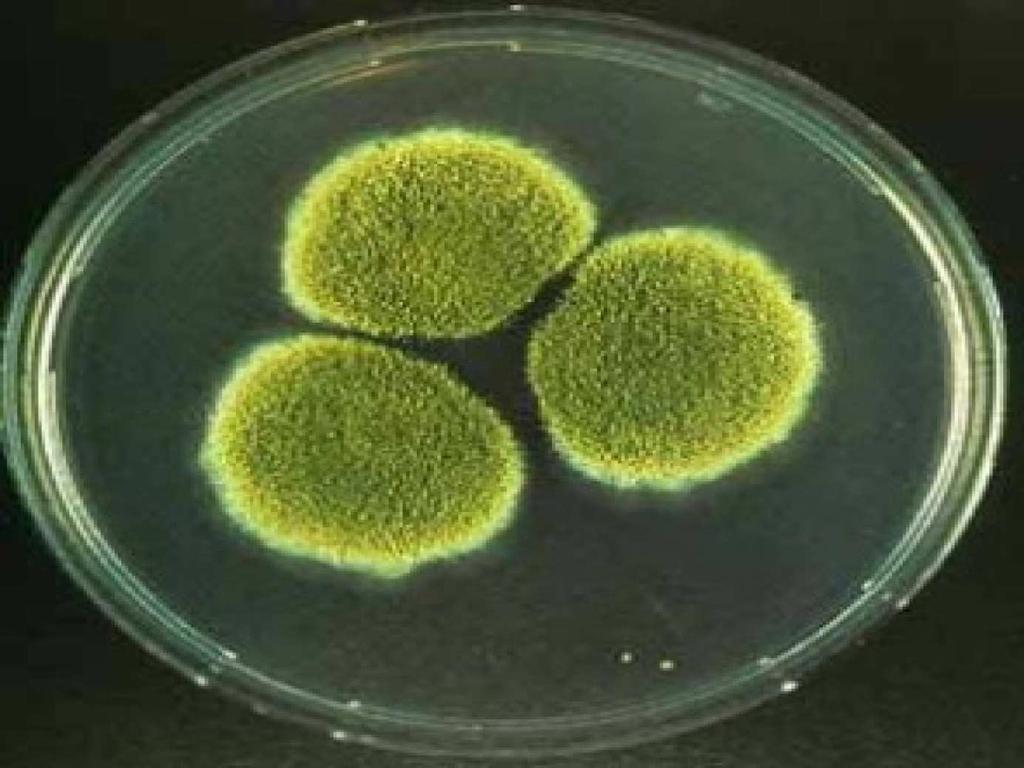 28 Şekil 4.4 Aspergillus sp.