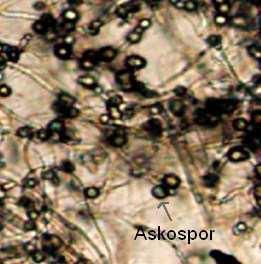 46 Şekil 4.29 Sclerotinia sp. Askosporları Şekil 4.