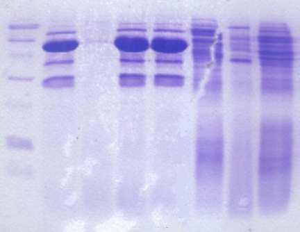 M 1 2 3 4 5 6 7 Şekil 4.4 Pediococcus pentosaceus suşlarının hücre duvarı protein içerikleri M Marker (kda): 180, 116, 97, 58.1, 39.8, 29, 20.1, 14.3, 6.5 1 BG19 (kda): 114.5, 107.2, 83.1, 53.1, 38.