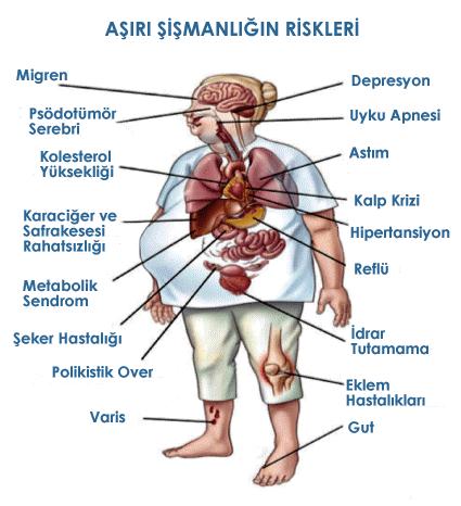 (overweigh), %95-99 persentil aralığı obezite grubunu ve son olarak ta %99 persentil ve üstü morbid obeziteyi (ölümcül obezite) riskini taģıyan grubun persentil dağılımını göstermektedir. 2.1.4.