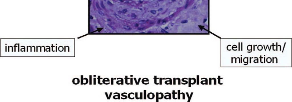 prototypic histologic lesion induced by