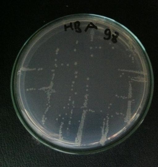 İnkübasyon sonucunda, plazmid içeren mutant bakterilerin ampisilinli ortamda büyüdükleri gözlenmiştir [Mc Cann v.d., 1975]. Yani bakteriler R faktör plazmidini içermektedirler. Resim 3.