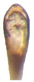 103 Resim 3. 70. Cassida sanguinolenta O. F. Müller, 1776 aedeagusun dorsal ve lateral görünüşü Cassida sanguinosa Suffrian, 1844 İncelenen materyal: Düzce: Düzce Üniv.