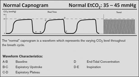 Normal Kapnogram ETCO 2 Neler Anlatır? - 1 1. End tidal karbondioksit, ilk olarak endotrakeal tüpün trakeal yerleşimini doğrular.