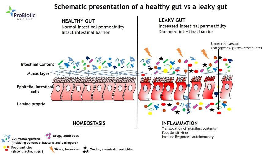 MİKROBİOTA & İMMUN SİSTEM 9 - İntestinal sistem, Lokal ve sist. immuniteyi etkileyen ve regulasyon fonk. olan tek sistem. 9,15 - Sistemik immun reaksiyonla ilgili 2 intestinal fonksiyon vardır: 1.