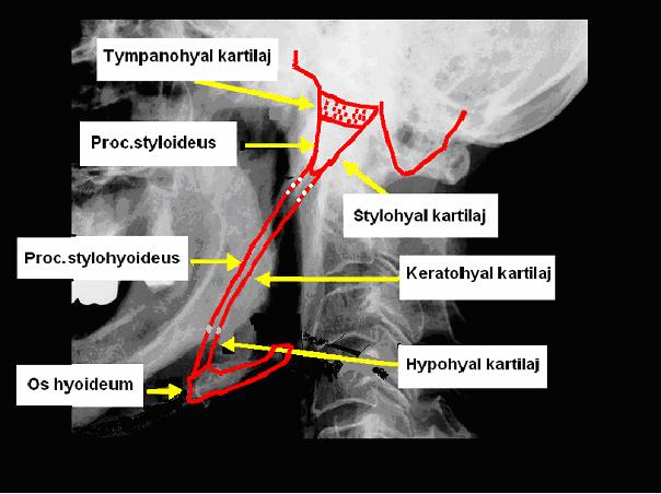 21 Şekil 1.3: İnsan Styloid Zinciri (Kirchhoff, 2006). Nadiren, keratohyal kartilajdaki kalsifikasyon, stylohyal kartilajdan bağımsız olarak meydana gelir.