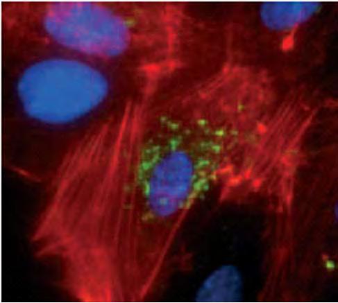 Nanomalzemelerin Fizyopatolojik Etkileri Liposomes Micellular and micro-emulsion Systems Liquid crystal based formulations Nanocrystals Antibodies and conjugates Naturally occurring proteins as