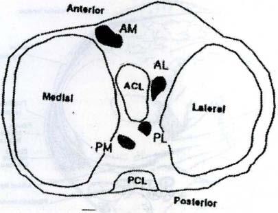 Lateral menisküs boynuzlarının insersiyonlarırun ön çapraz bağ insersiyonuna ve birbirlerine olan yakınlıklanna dikkat ediniz. ACL. Ön çapraz bağ, PCL. Arka çapraz bağ, AM.