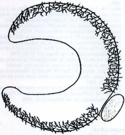 Laıeral menisküsıe hiaıus popliteus önünde küçük bir segmentin pleksustan kanlanması yokıur (23) san menisküs dokusunda bu reseptörleri bulamamışlardır. Buna karşılık Kennedy ve ark.