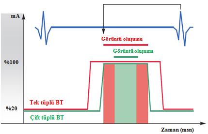 Şekil 2.18 EKG kontrollü ma ayarı kullanıldığında kalbin tam bir atımı sırasında ma deki değişim. Nominal ma değerinin tamamen sıfıra indirilmemesinin iki nedeni vardır.