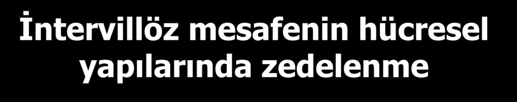 İntervillöz mesafenin hücresel yapılarında zedelenme 1. Hücre yıkım ürünlerinin intervillöz mesefedeki maternal kana dökülmesi 2.