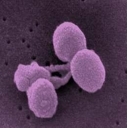 Streptococcus pneumoniae, TKP, menenjit ve baktereminin başlıca nedenidir. Image obtained from the website of the Centers for Disease Control and Prevention/Janice Carr. http://phil.cdc.