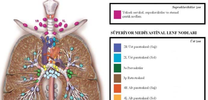 Ao: Aort, mpa: Ana pulmoner arter, Eso: Özofagus, SVC: Vena Cava Superior, T: Trakea Şekil 2.