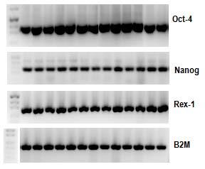 Sağlıklı grubuna ait CD34- hücrelerde Oct-4, Nanog, Rex-1 ve B2M için PCR ürünlerinin % 2 lik agaroz jeldeki görüntüleri Şekil 12 de gösterilmektedir.