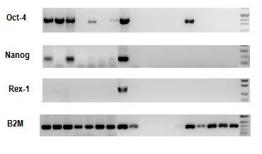 4.2.3 KML Hasta Grubuna ait CD34+CD38- Hücrelerdeki PCR Amplifikasyonları: KML olgularındaki CD34+CD38- hücrelerine ait Oct-4, Nanog, Rex-1 ve B2M için PCR ürünlerinin % 2 lik agaroz jeldeki