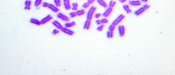 lenfositlerinde gözlenen kromozom