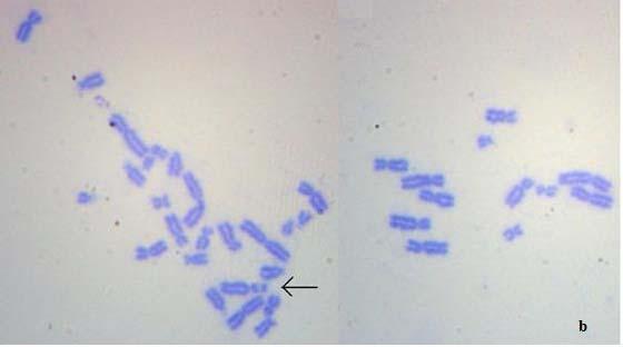 anormallikleri a) kromatid kırığı, b) kromozom