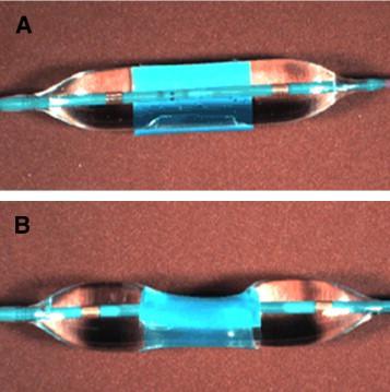 Stent kutusu üzerindeki basınç skalasına göre tahmin edilen minimal stent çapının ancak