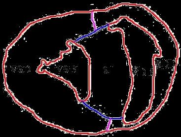 Septum interventriculare olarak belirlendi (SI). Tüm ventriculus kesitinin alt bileşenlerinin sınırları şematize edilmiş şekle göre alındı (Şekil 3). ġekil 1. Stereolojik kesit alımı. Figure 1.