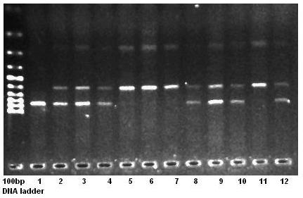 38 TPH1 geninin A aleliyle uyumlu 848 bp, enzimle kesilen pcr ürünleri C aleli ile uyumlu olarak 597bp ve 251bp iki fragman verdi (Şekil 9).