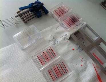 CDC-XM Yöntem olarak Serolojik HLA