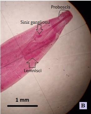 Proboscis 52-68 µm boyunda ve 23-37 µm enindedir. Birinci ve ikinci kancanın sivri uçlu gövde kısmı 47-132 µm, kök kısmı 51-63 µm olarak kaydedilmiştir.