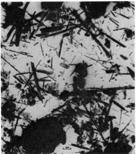 Şekil 4: İğne gibi, düz tremolit lifleri Şekil 5: Kıvrık krizotil lifleri Her ne kadar hayvan deneyleri tüm asbest formlarının eşit oranda karsinojenik ve doz bağımlı etkisi olduğunu gösterse de