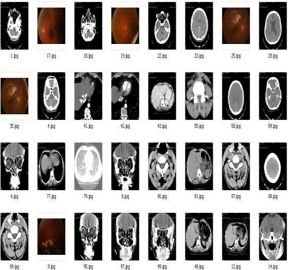 Medial Görütüler İçi Siyal İşleme Metotlarıı Kullaa İçeri Tabalı Bir Görütü Erişim Sistemi Freas ve yöelim arateristilerie göre isa görme sistemiyle büyü bezerli göstere Gabor dalgacıları özellile