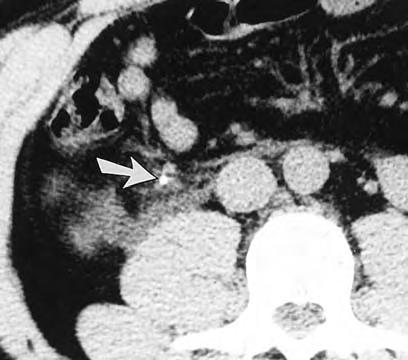 STEM CT