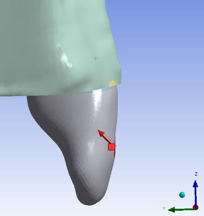 Kuvvet yönleri; F1- Horizontal kuvvet yönü ( kronun labial yüzeyinin ortasındaki 3,17 mm 2 lik