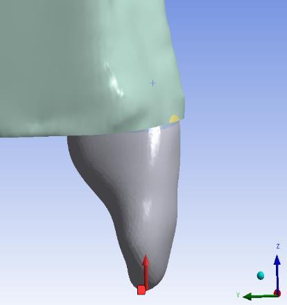 alana dişin uzun aksına 45 o açıyla) F3- Vertikal kuvvet yönü ( insizal kenarın ortasındaki