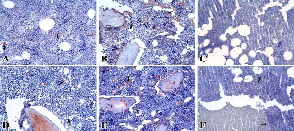 Gül ve ark; Doku ve Hücre Bütünlüğünün Korunması Açısından Üç Farklı Dekalsifikasyon Yönteminin Karşılaştırması İmmunohistokimyasal Analiz RDO ve EDS gruplarında OPN ve OCN için immünreaktivite