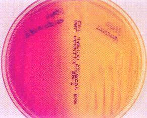 Aynı stafilokok suşu, değişik ortamlarda değişik renkte pigment oluşturabilir (Hasbek, 2002). S. aureus kanlı agarda beta hemoliz yapar (Çalık, 1998; Cengiz, 1999; Leloğlu, 1999).