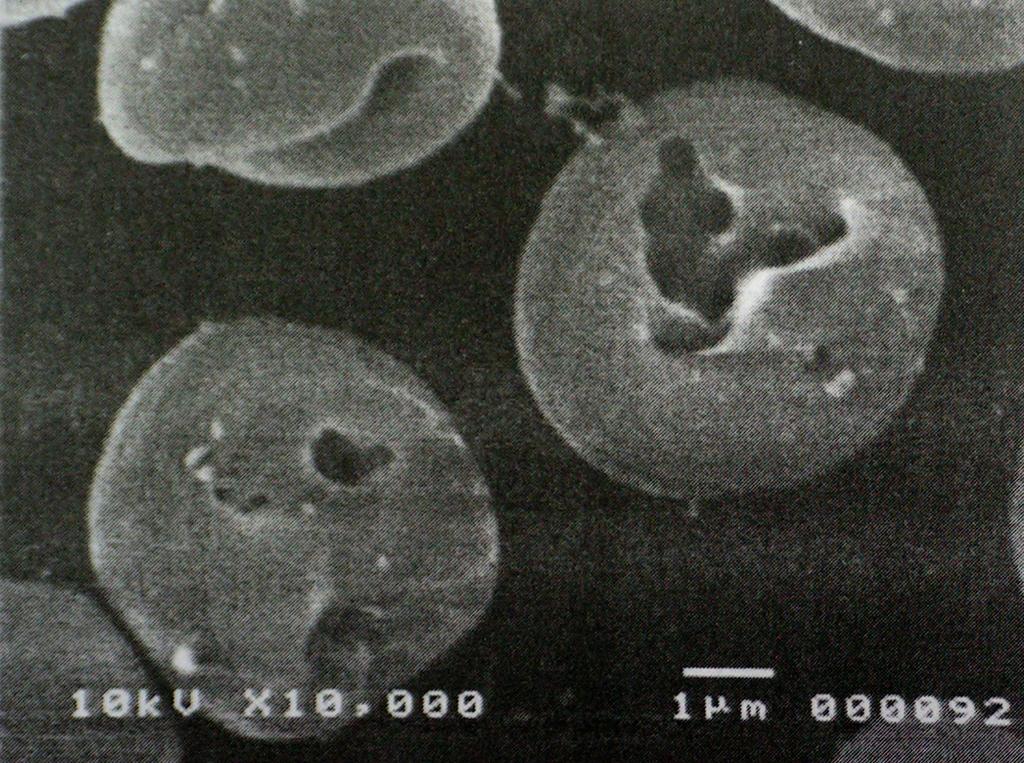 Şekil 6: Sıcaklık 4 o C ye ayarlandıktan sonra, beta toksinin sebep olduğu, insan eritrosit membran yüzeyindeki lezyonların scanning elektron mikroskop görüntüsü.