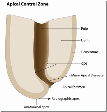 Kanal Tedavisinde Çalışma Boyunun Önemi Endodontik tedavinin en önemli evresi olan biy4omekanik şekillendirme işlemlerinden önce gerçek kök kanal uzunluğunun tam olarak belirlenmesi gerekir.