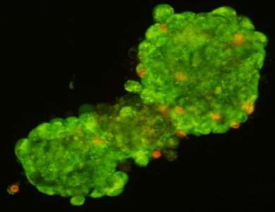 vermektedir. Vital bir boya olan akridin oranj hem canlı hem ölü hücreleri, etidyum bromid ise sadece membran bütünlüğü bozulmuş hücreleri boyamaktadır.