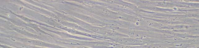 Şekil 20: HPDLF hücrelerinin 22 günlük kültürünün ışık mikroskop görüntüsü (10X büyütme, Olympus, Tokyo, Japonya, Model No: CK40) HPDLF hücrelerinin üretilmesi ve testleri sırasında kullanılan