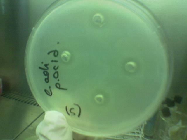 4.ARAŞTIRMA BULGULARI VE TARTIŞMA Resim 4.4. E. coli nin P. aeroginosa PR3 suşu ile elde edilen bepa ve bdha ekstraktı tarafından oluşturduğu inhibisyon zon görünümü.