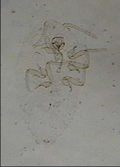 dönem larvalarda özellikle vücut kenarlarında tüp şeklinde kanalların