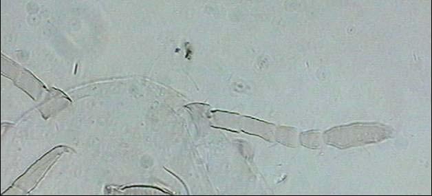 dönem larvalarının boyunun ortalama 1.1 mm, eninin 0.