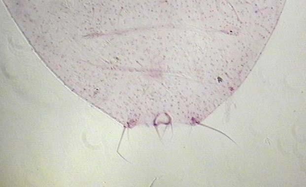 13.08.2003 tarihinde Maltepe Mehmet Baydar Sokakda Mayridia pulchra (Hymenoptera: Encyrtidae) elde edilmiştir. Şekil 4.19. Phenacoccus bicerarius un anal lobu ve cerariler.